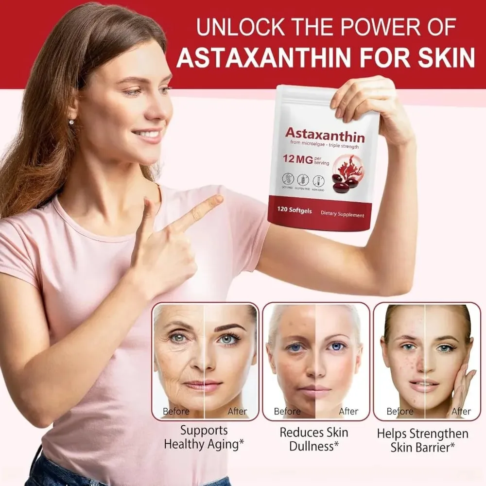 Astaxanthin 12mg Softgels תמיכה בנוגדי חמצון בעוצמה משולשת לעור מפרקי עיניים ובריאות החיסונית - אספקה ​​של 120 ספירות למשך 4 חודשים